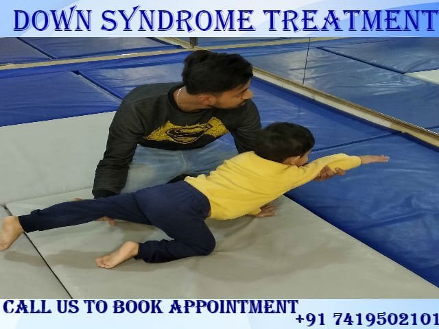 Down Syndrome Treatment in India